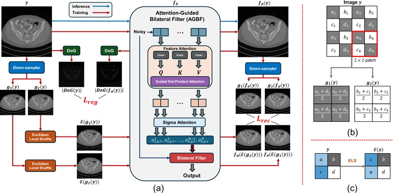 AI Denoises CT Scans: Clearer Images with Less Radiation?