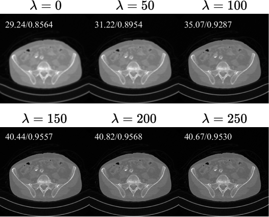 Ablation study on λ (Equation 10). PSNR and SSIM values are shown.