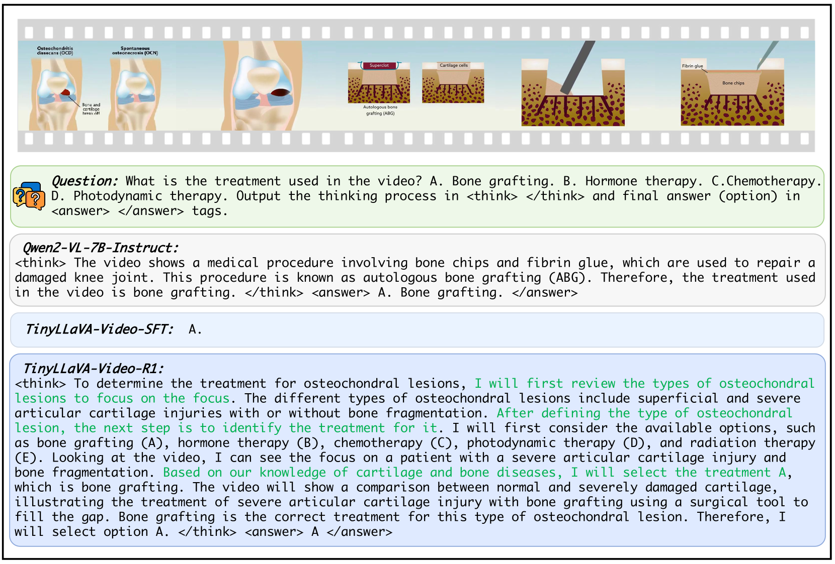 A case of TinyLLaVA-Video-R1 on video reasoning data, sourced from MMVU. The model demonstrates comprehensive video content understanding and the capability to derive correct answers through analytical reasoning.